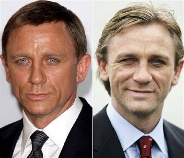 Daniel Craig Plastic Surgery Before and After